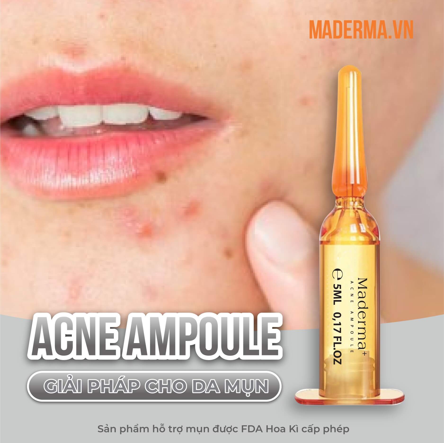 tinh-chat-mun-maderma-10